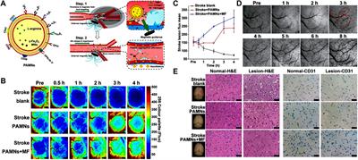 Application of stimuli-responsive nanomedicines for the  - Frontiers